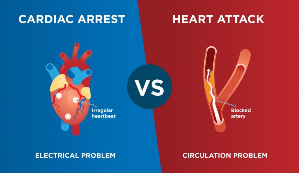 Heart Attack vs Cardiac Arrest